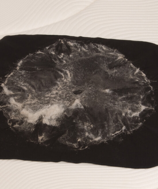 Collected Dust Mites Dead Skin After Mattress Cleaning